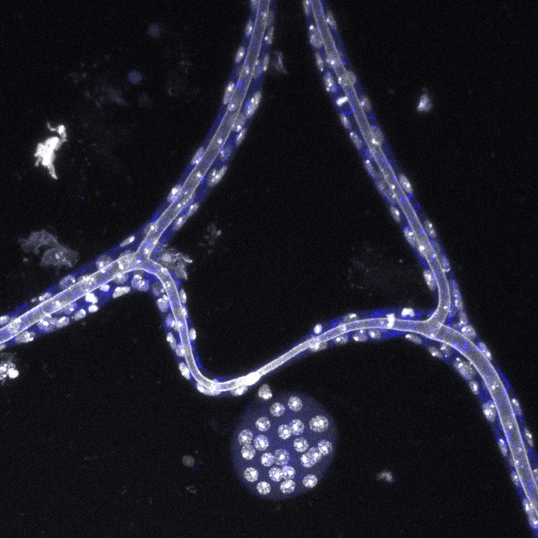 A drosophila Ring Gland where the prothoracic gland is missing