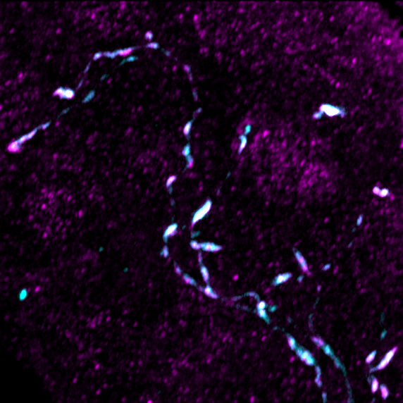the neuropeptide PTTH colocalised with its receptor torso