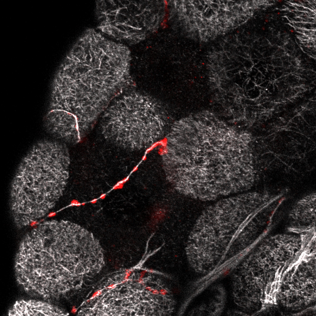 staining of PTTH and tubuline in a drosophila ring gland mutant